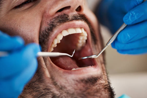 Best Weekend Emergency Dentist in Garrettsville, OH